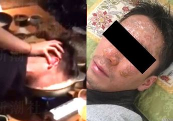 Demi Hibur Klien, Direktur Ini Tega Benamkan Kepala Karyawannya ke Panci Air Panas