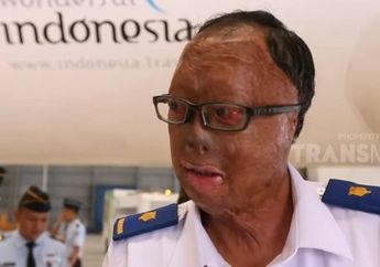 Pernah Terbakar di Pesawat,Begini Kisah Kapten Sigit yang Tetap Lakukan Penerbangan