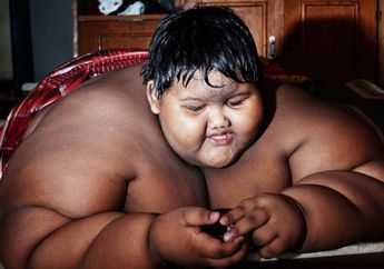 Turun 102 KG dengan Hanya Makan Lima Sendok dan Satu Lauk, Begini Penampilan Arya Permana, Bocah Obesitas 200 KG