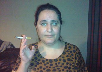 Wanita Ini Makan 8 Putung Rokok dan 250 gr Kapur Tiap Hari, Begini Kondisinya Sekarang!