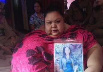 Kondisi Terkini Titi Wati Perempuan Berbobot 220 Kg, 3 Minggu Pasca Operasi Bariatrik, Sudah Bisa Berdiri Hingga Makin Lincah