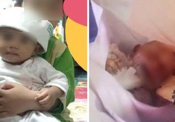 Sedang Dirawat Oleh Pengasuh, Bayi Berusia 7 Bulan Ini Meninggal dengan Cedera Kepala dan Pendarahan Dalam