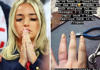 Jarinya Membengkak saat Hamil, Wanita ini Harus Rela Potong Cincin Berlian Senilai Rp12,7 Miliar
