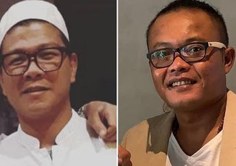 Tak Mau Ketinggalan dari Babang Tamvan, Sule Juga Lakukan Perawatan Mahal