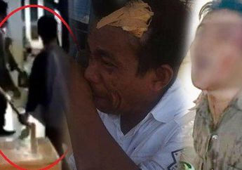 Ironis, Orang Tua dan Siswa Keroyok Staff Sekolah hingga Alami Luka Robek