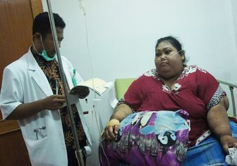 Mirip Kasus Titi Wati, Lambung Wanita Asal Karawang Ini Dipotong Hingga Sisa Sepertiga Karena Obesitas