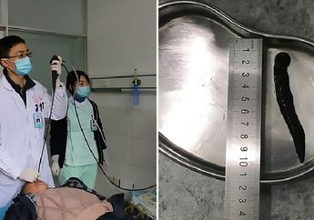 Lintah Sepanjang 10 Cm Ditemukan di Tenggorokan Pria Ini Setelah Minum Air, Perhatikan Hal Ini Pada Air Minum Anda!