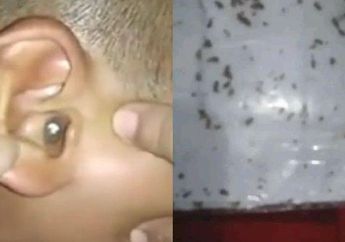 Viral Video Anak Kecil Telinganya Kemasukan Ribuan Semut, Jangan Panik Begini Cara Menanganinya