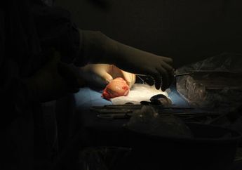 Laku Keras di Pasar Gelap, Ternyata Segini Harga Jual Setiap Organ Tubuh Manusia, Ada yang Cuma Ratusan Ribu Rupiah