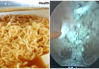 VIDEO POPULER: Inilah yang Terjadi dalam Perut saat Kita Mengonsumsi Mi Instan, Mengerikan...