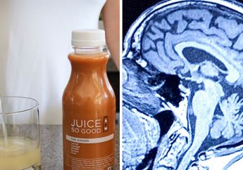 Waspada! Wanita Ini Alami Kerusakan Otak Setelah Minum Jus Pelangsing, Dokter Kaget Saat Temukan Hal Tak Terduga Ini