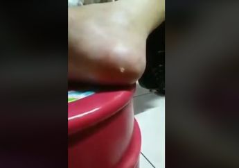Viral Cara Sembuhkan Penyakit Mata Ikan Tanpa Operasi dengan Kulit Pisang, 3 Hari Mata Ikan Lenyap!