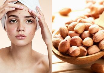 Menghindari Kacang Karena Jerawat, Kamu Justru Bisa Alami Hal Buruk ini!