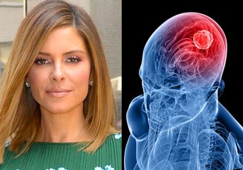 Alami Gejala Sepele dan Mengira Hanya Stres Kerja, Presenter Wanita Ini Ternyata Menderita Tumor Otak Sebesar Bola Golf!
