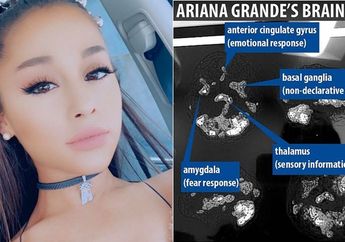 Ariana Grande Alami Trauma Selama 2 Tahun, Hasil Scan Otaknya Mengerikan