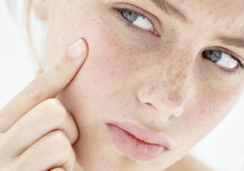 Cara Mudah Tutupi Bekas Jerawat dengan Makeup di Bawah Rp 100 Ribu
