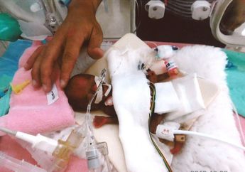 Jadi Bayi Laki-Laki Terkecil di Dunia Karena Hanya Seberat Apel, Begini Nasibnya Setelah 6 Bulan Ditahan di Rumah Sakit