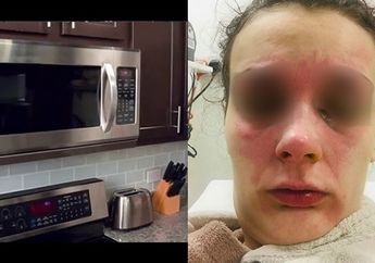 Masak Telur di Microwave, Remaja ini Justru Harus Kehilangan Penglihatannya!