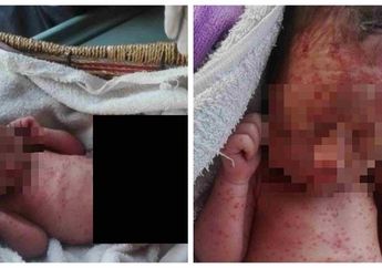 Kejam! Bayi Masih Bertali Pusar Ditelantarkan, Sekujur Tubuhnya Digigiti Nyamuk