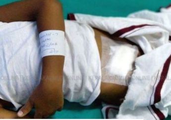 Harusnya Mengoperasi Hidung, Sang Dokter Justru Mengambil Ginjal Anak ini!