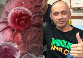 Belajar dari Agung Hercules, Jangan Pernah Abaikan Kondisi Sepele ini yang Bisa jadi Gejala Awal Kanker Otak! Hati-hati