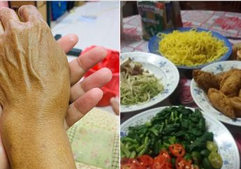 Masak Sambil Tahan Sakit Karena Tangan Patah, Ibu Ini Malah Kecewa Karena Keluarga yang Ditunggu Tak Kunjung Datang