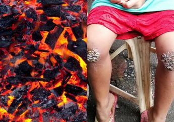 Kisah Pilu Bocah SD Disiksa Ibunya Sendiri, Dipaksa Berlutut di Atas Bara Api Cuma karena Tasnya Tertinggal di Sekolah