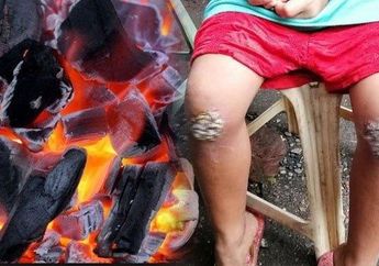 Tragis! Bocah 8 Tahun Dihukum Ibunya Berlutut di Atas Bara Api Hanya Karena Hal Sepele