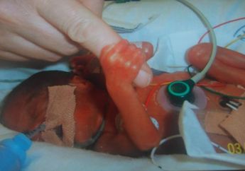 Dokter Angkat Tangan, Orang Tuanya Juga Pasrah pada Bayi yang Divonis 'Berumur Pendek' Ini, Namun Saat Semua Menyerah Keajaiban Justru Terjadi