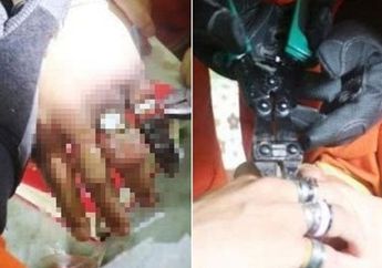 Niat Bergaya Nyentrik , Jari Pria ini Berubah Jadi Mengerikan Setelah Kenakan 53 Cincin Sekaligus