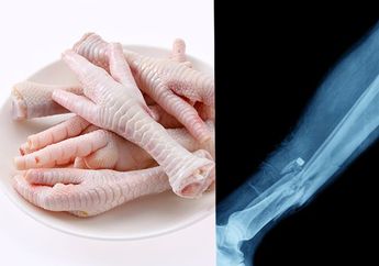Jenius! Tiga Mahasiswa UGM Ini Berhasil Ciptakan Obat Patah Tulang Dari Limbah Ceker Ayam