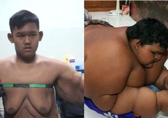 Bobotnya Turun Ratusan Kilo, Begini Prosedur Bedah Plastik yang Dilakukan Aria Permana
