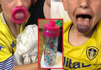Orang Tua Harus Waspada! Bocah 6 Tahun Ini Hampir Meregang Nyawa Karena Lidahnya Tersangkut di Tutup Botol Minum!