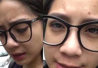 Bak Petir di Siang Bolong, Wajah Nagita Slavina Alami Masalah Kesehatan Ini Usai Kabarkan Hamil Anak Kedua: Waktu Hamil Rafathar Aku Nggak Begini