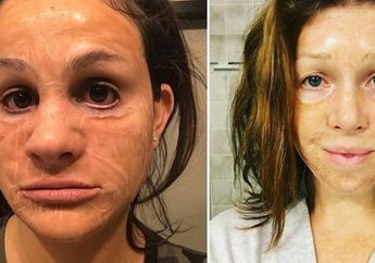 Bukannya Cantik Masker Unik ini Bikin Kulit Keriput Seperti Nenek-nenek, Berani Coba?