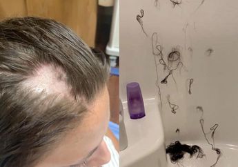 Gadis Ini Panik Saat Rambut Panjangnya Cuil dan Rontok Usai Pakai Conditioner, Ternyata karena Dicampur Krim Pencukur Rambut oleh Orang Iseng di Toko