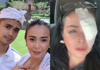 Dulu Nikah Mewah di Pulau Dewata, Kini Istri Ajun Perwira Harus Menanggung Rasa Sakit, Ada Apa?