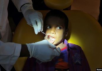 Rekor Dunia Medis, Tim Dokter Ini Berhasil Cabut Lebih Dari 500 Gigi dari Dalam Mulut Anak Laki-laki!