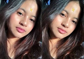 3 Tahun Berlalu, Begini Kondisi Terkini Zanette Usai Selamat dari Tragedi Pulomas yang Menewaskan Ayah dan Saudara Kandungnya