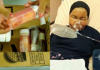 Kulit Melepuh Usai Pakai Krim Pelembap Wajah Palsu, Ini Cara Aman Sebelum Belanja Online Produk Kecantikan!