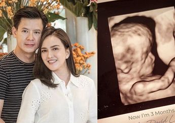 Istrinya Tak Bisa Masak dan 8 Tahun Belum Dikaruniai Anak, Suami Ungkap Alasan Tak Tinggalkan Shandy Aulia