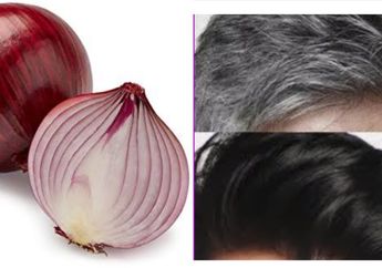 Tak Perlu Cat Rambut, Begini Cara Mengatasi Uban Secara Alami dengan Bawang Merah