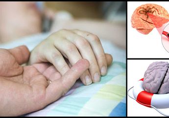Tiba-tiba Menyerang tanpa Gejala, 5 Makanan Favorit Ini Jadi Penyebab Stroke di Usia Muda! Sering Anda Makan?