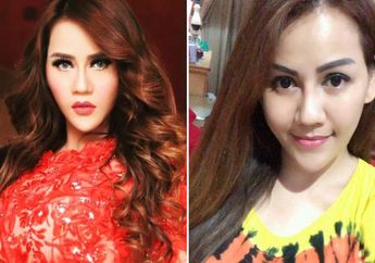 Sudah Rogoh Miliaran Rupiah, Pedangdut Molek Ini Wajahnya Lumpuh Gara-Gara Operasi Plastik!