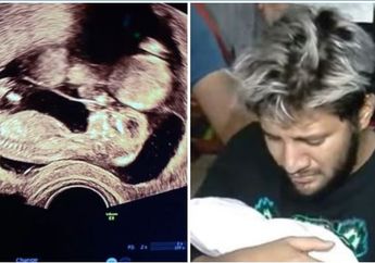 Sebulan Sebelum Bayi Kembarnya Meninggal dalam Kandungan, Ammar Zoni Pernah Bisikan Doa dan Unggah Potretnya Dibarengi Pesan Menyentuh