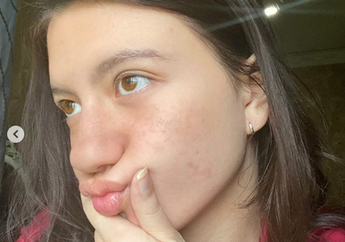 Unggah Foto Ini, Cassandra Lee Dapat Dukungan dari Prilly Latuconsina!