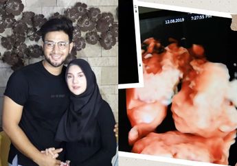Buktikan Omongan Adalah Doa, Irish Bella Akui 'Ketulah' Kalimat sang Suami hingga Kehilangan Bayi Kembar Dalam Kandungan, Ammar Zoni: Gue Belum Siap Jadi Bapak