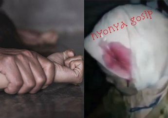 Jual Obat Nyamuk Demi Sesuap Nasi, Nenek Tua Ini Berkucuran Darah Dipukuli Bocah 18 Tahun Karena Menolak Diajak Berhubungan Intim