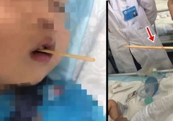Sering Beli Makanan yang Disajikan Dengan Cara Ditusuk? Hati-hati, Anak Ini Alami Hal Mengerikan Setelah Diberi Makanan Tersebut