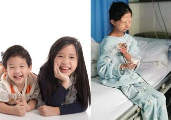 Viral! Seorang Kakak Rela Makan Rp 4 Ribu Sehari untuk Bertahan Hidup Demi Kesehatan Adiknya Hingga Kurus Kering